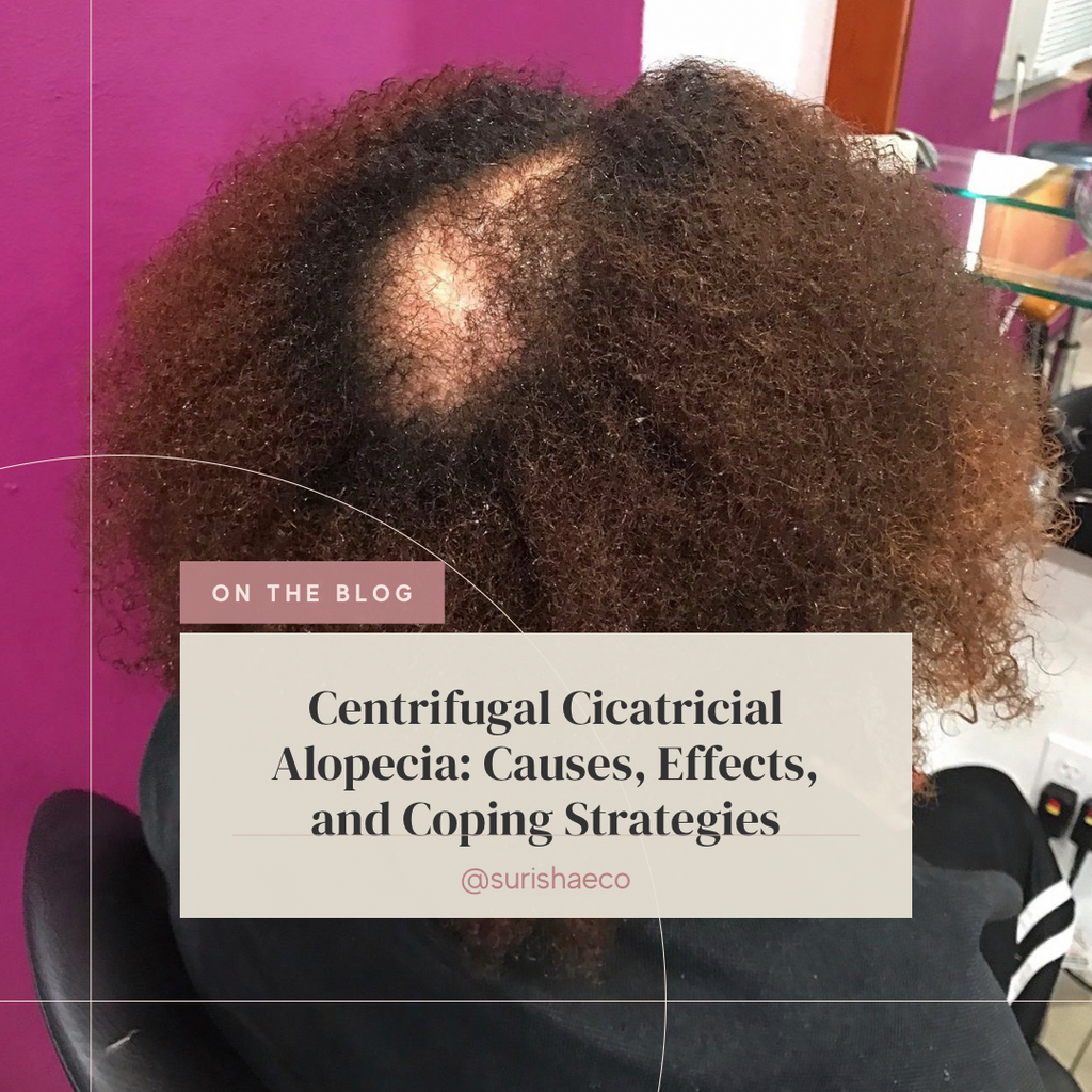 Centrifugal Cicatricial Alopecia: Causes, Effects, and Coping Strategies