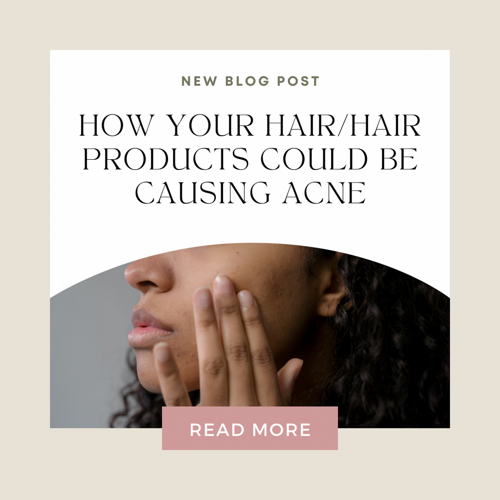 How Your Hair Could Be Causing Acne: Understanding the Connection